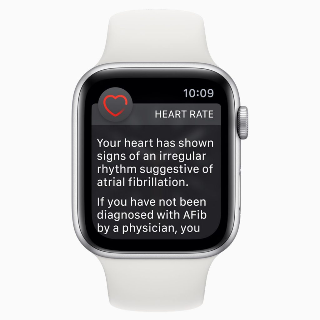 apple ki touch watch
