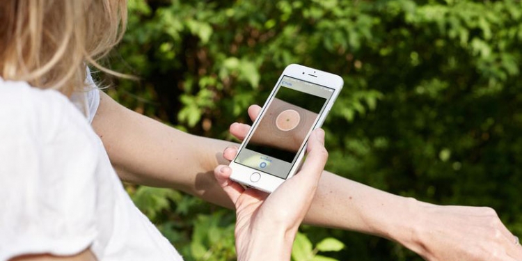 Google akan bantu analisis masalah kulit anda melalui kamera