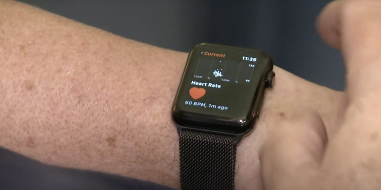 Apple Watch selamatkan nyawa wanita ini dengan beri amaran tentang denyutan jantung