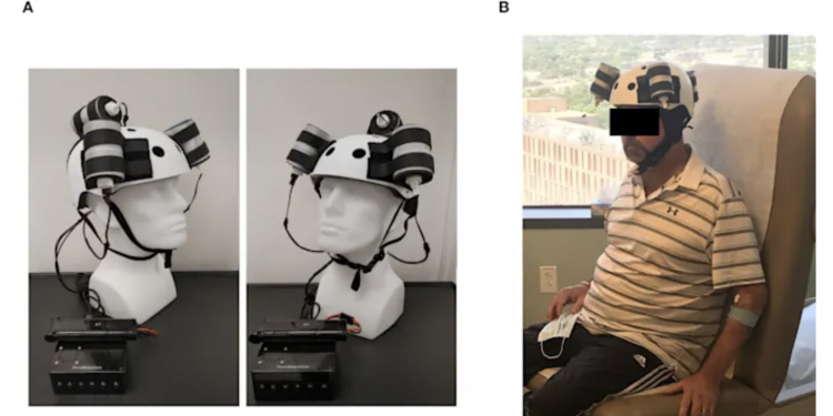 Penyelidik buktikan topi keledar magnet ini boleh kecutkan barah otak Glioblastoma