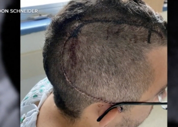 Pengsan sendirian di dalam tandas, Apple Watch selamatkan lelaki ini