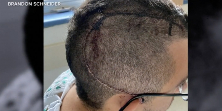 Pengsan sendirian di dalam tandas, Apple Watch selamatkan lelaki ini