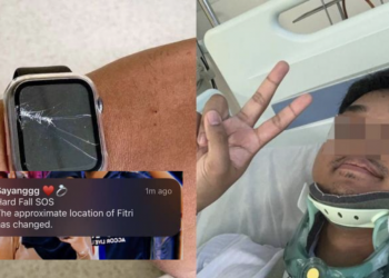 Mangsa langgar lari pengsan setelah kemalangan, Apple Watch bantu panggil ambulan