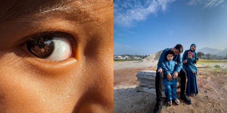 Gambar mata rakyat Malaysia dapat pengiktirafan Apple