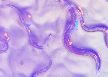 Cacing mampu kesan barah dalam badan