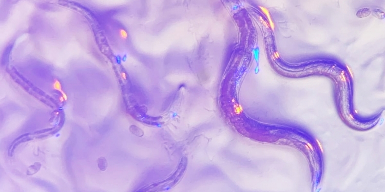 Cacing mampu kesan barah dalam badan