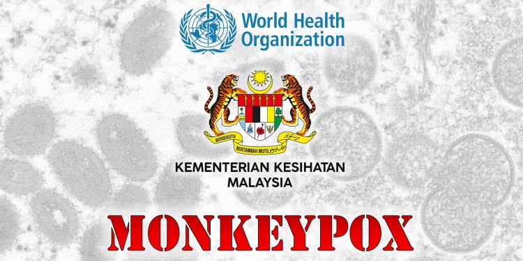 WHO letak monkeypox dalam senarai yang sama dengan COVID-19, apa maknanya kepada Malaysia?